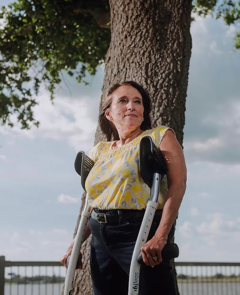 A woman with forearm crutches stands beneath a tree.